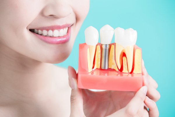 имплантация зубов от stomatologiya-konova.com