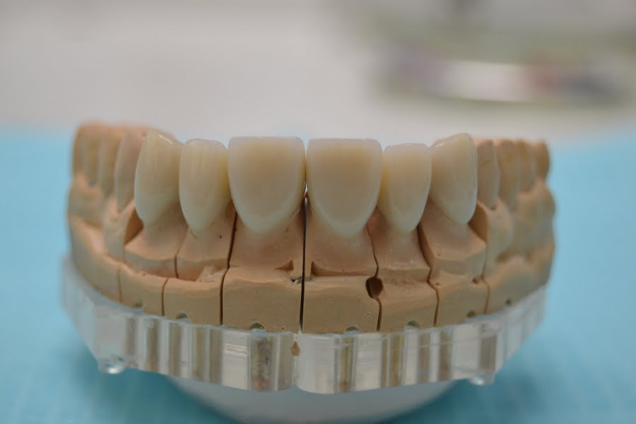 протезирование зубов от stomatologiya-konova.com