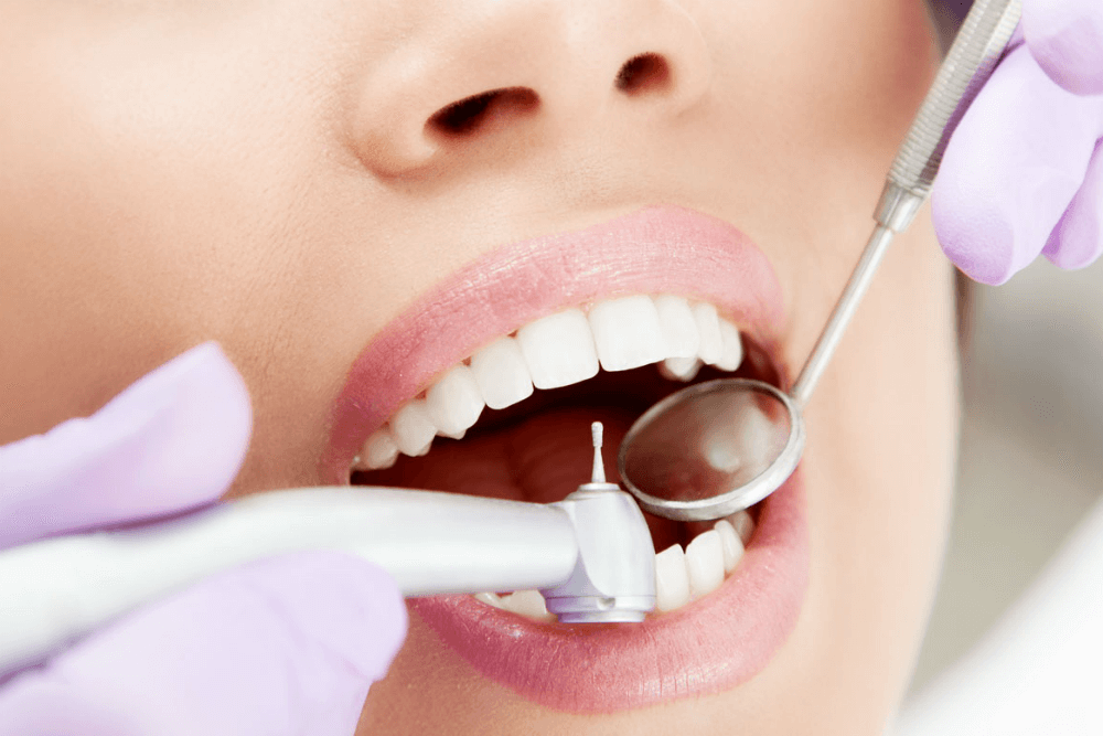 Лікування зубів від stomatologiya-konova